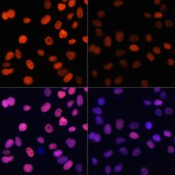 Invitrogen H4K91ac Polyclonal Antibody 100 &mu;L; Unconjugated:Antibodies,