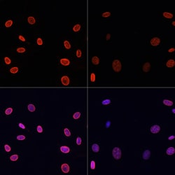 Invitrogen H4K91ac Polyclonal Antibody 100 &mu;L; Unconjugated:Antibodies,