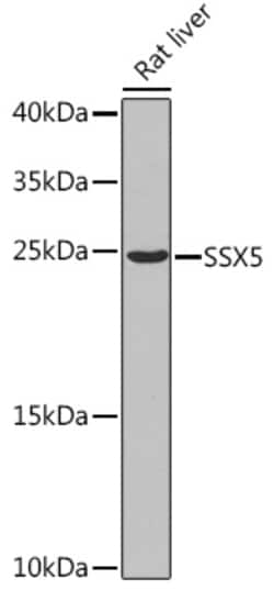 Invitrogen SSX5 Polyclonal Antibody 100 &mu;L; Unconjugated:Antibodies,