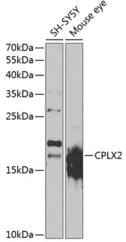 Invitrogen CPLX2 Polyclonal Antibody 100 &mu;L; Unconjugated:Antibodies,