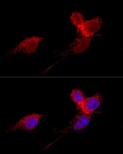 Invitrogen RPL36 Polyclonal Antibody 100 &mu;L; Unconjugated:Antibodies,