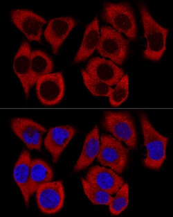 Invitrogen RPL36 Polyclonal Antibody 100 &mu;L; Unconjugated:Antibodies,