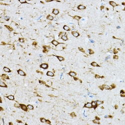 Invitrogen RPL36 Polyclonal Antibody 100 &mu;L; Unconjugated:Antibodies,