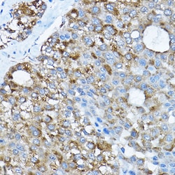 Invitrogen RPL36 Polyclonal Antibody 100 &mu;L; Unconjugated:Antibodies,