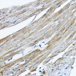Invitrogen RPL36 Polyclonal Antibody 100 &mu;L; Unconjugated:Antibodies,