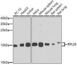 Invitrogen RPL36 Polyclonal Antibody 100 &mu;L; Unconjugated:Antibodies,
