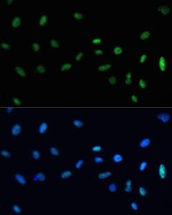 Invitrogen SAFB Polyclonal Antibody 100 &mu;L; Unconjugated:Antibodies,