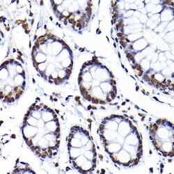 Invitrogen SAFB Polyclonal Antibody 100 &mu;L; Unconjugated:Antibodies,