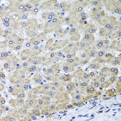 Invitrogen OSGEPL1 Polyclonal Antibody 100 &mu;L; Unconjugated:Antibodies,