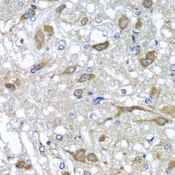 Invitrogen OSGEPL1 Polyclonal Antibody 100 &mu;L; Unconjugated:Antibodies,