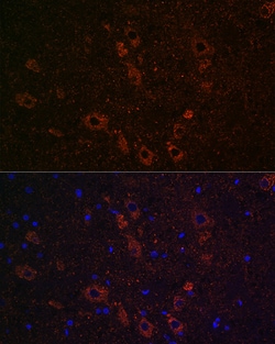 Invitrogen SLC5A7 Polyclonal Antibody 100 &mu;L; Unconjugated:Antibodies,