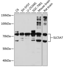 Invitrogen SLC5A7 Polyclonal Antibody 100 &mu;L; Unconjugated:Antibodies,