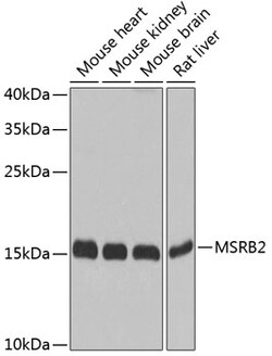 Invitrogen MSRB2 Polyclonal Antibody 100 &mu;L; Unconjugated:Antibodies,