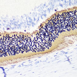 Invitrogen PDC Polyclonal Antibody 100 &mu;L; Unconjugated:Antibodies,