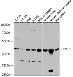 Invitrogen Protease-Activated Receptor-4 Polyclonal Antibody 100 &mu;L;
