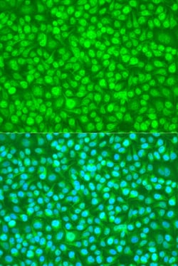 Invitrogen N4BP1 Polyclonal Antibody 100 &mu;L; Unconjugated:Antibodies,