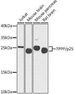 Invitrogen TPPP Polyclonal Antibody 100 &mu;L; Unconjugated:Antibodies,
