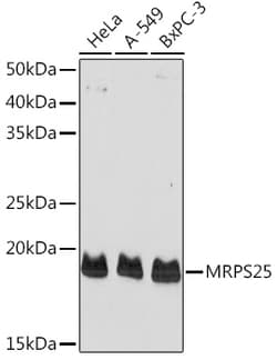 Invitrogen MRPS25 Polyclonal Antibody 100 &mu;L; Unconjugated:Antibodies,