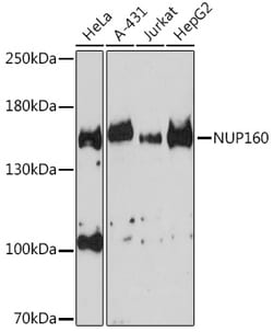 Invitrogen NUP160 Polyclonal Antibody 100 &mu;L; Unconjugated:Antibodies,