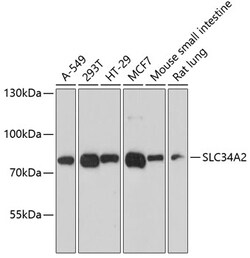 Invitrogen SLC34A2 Polyclonal Antibody 100 &mu;L; Unconjugated:Antibodies,
