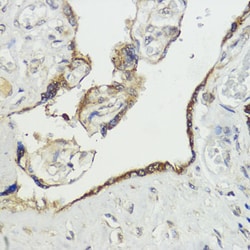 Invitrogen HACE1 Polyclonal Antibody 100 &mu;L; Unconjugated:Antibodies,