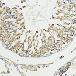 Invitrogen HACE1 Polyclonal Antibody 100 &mu;L; Unconjugated:Antibodies,