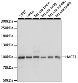 Invitrogen HACE1 Polyclonal Antibody 100 &mu;L; Unconjugated:Antibodies,