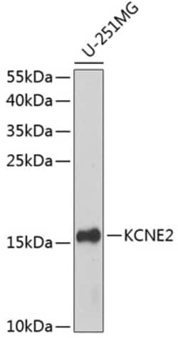 Invitrogen&trade;&nbsp;KCNE2 Polyclonal Antibody