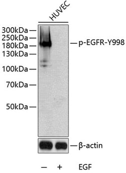 Invitrogen Phospho-EGFR (Tyr998) Polyclonal Antibody 100 &mu;L | Buy Online | Invitrogen&trade; | Fisher Scientific