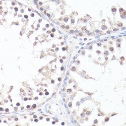 Invitrogen Phospho-c-Myc (Thr58) Polyclonal Antibody 100 &mu;L; Unconjugated:Antibodies,
