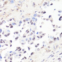 Invitrogen Phospho-c-Myc (Thr58) Polyclonal Antibody 100 &mu;L; Unconjugated:Antibodies,