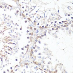 Invitrogen Phospho-c-Myc (Thr58) Polyclonal Antibody 100 &mu;L; Unconjugated:Antibodies,