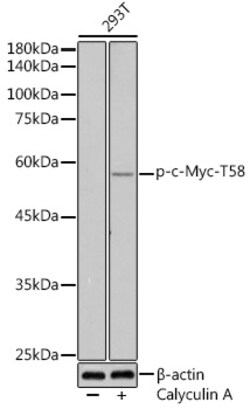 Invitrogen Phospho-c-Myc (Thr58) Polyclonal Antibody 100 &mu;L; Unconjugated:Antibodies,