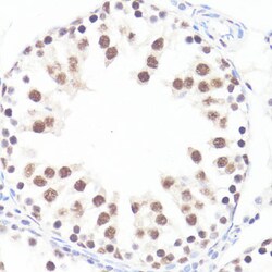 Invitrogen Phospho-c-Myc (Ser62) Polyclonal Antibody 100 &mu;L; Unconjugated:Antibodies,