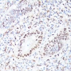 Invitrogen Phospho-c-Myc (Ser62) Polyclonal Antibody 100 &mu;L; Unconjugated:Antibodies,