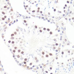 Invitrogen Phospho-c-Myc (Ser62) Polyclonal Antibody 100 &mu;L; Unconjugated:Antibodies,