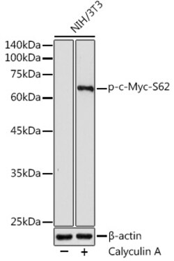Invitrogen Phospho-c-Myc (Ser62) Polyclonal Antibody 100 &mu;L; Unconjugated:Antibodies,