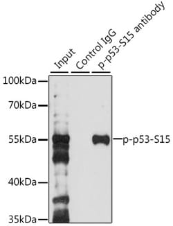 Invitrogen Phospho-p53 (Ser15) Polyclonal Antibody 100 &mu;L; Unconjugated:Antibodies,