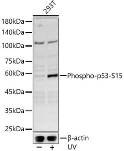 Invitrogen Phospho-p53 (Ser15) Polyclonal Antibody 100 &mu;L; Unconjugated:Antibodies,
