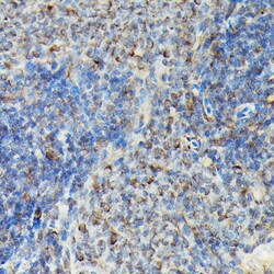 Invitrogen Phospho-VASP (Ser239) Polyclonal Antibody 100 μL; Unconjugated:Antibodies,