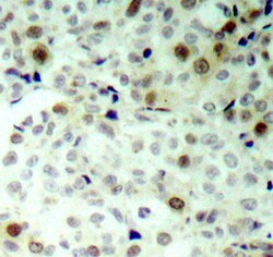 Invitrogen Phospho-CDK2 (Thr160) Polyclonal Antibody 100 &mu;L; Unconjugated:Antibodies,