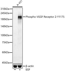 Invitrogen Phospho-VEGF Receptor 2 (Tyr1175) Polyclonal Antibody 100 &mu;L;