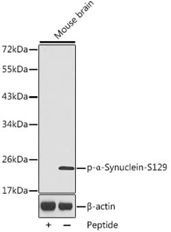 Invitrogen Phospho-alpha Synuclein (Ser129) Polyclonal Antibody 100 &mu;L | Buy Online | Invitrogen&trade; | Fisher Scientific