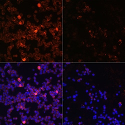 Invitrogen Phospho-Zap-70 (Tyr493) Polyclonal Antibody 100 &mu;L; Unconjugated:Antibodies,