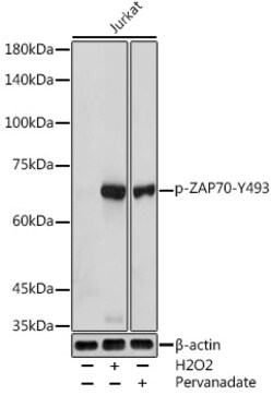 Invitrogen Phospho-Zap-70 (Tyr493) Polyclonal Antibody 100 &mu;L; Unconjugated:Antibodies,