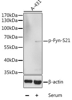 Invitrogen Phospho-Fyn (Ser21) Polyclonal Antibody 100 μL; Unconjugated:Antibodies,