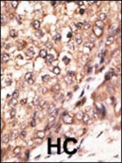Invitrogen BMP-7 Polyclonal Antibody 400 &mu;L; Unconjugated:Antibodies,
