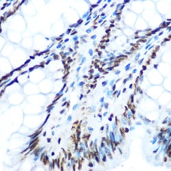 Phospho-IRS1 (Ser612) Polyclonal Antibody:Antibodies, Polyclonal