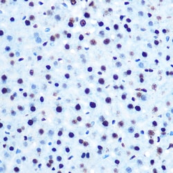 Phospho-IRS1 (Ser612) Polyclonal Antibody:Antibodies, Polyclonal