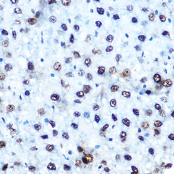 Phospho-IRS1 (Ser612) Polyclonal Antibody:Antibodies, Polyclonal